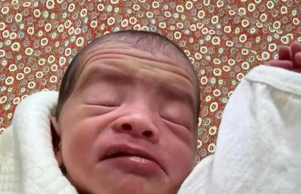 孩子刚出生都这样吗？
怎么跟小老头似的？