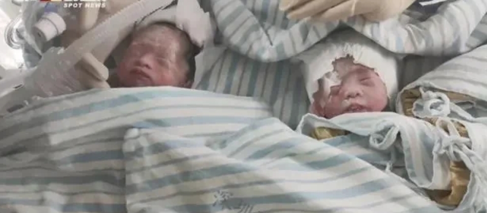 二孩夫妻又生4胞胎，这五点万万没想到：

1、没想到新闻竟然没有提及四胞胎的性别