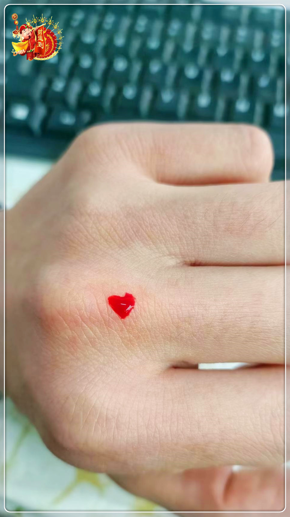 恋爱之情溢满全身，每处伤口都似爱之印记。