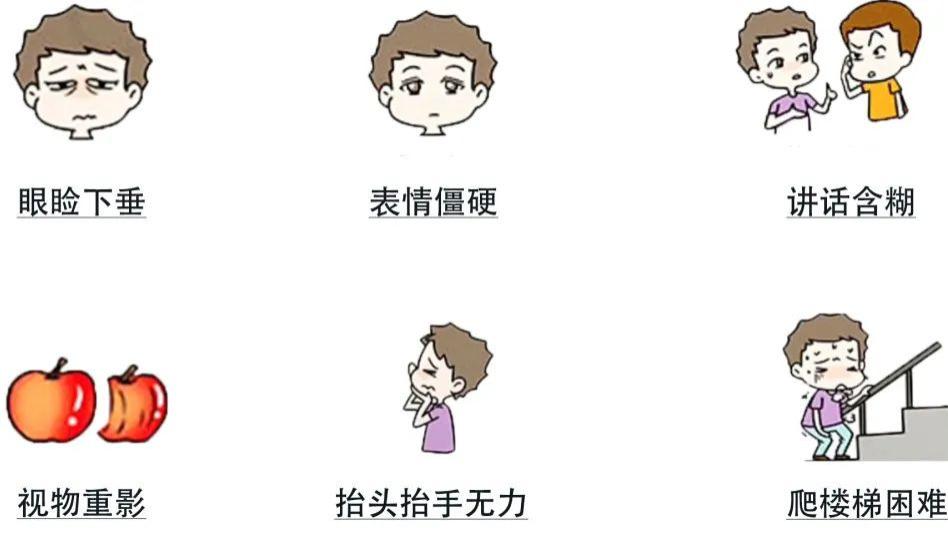 眼皮下垂，睁不开眼睛？是没休息好？小心重症肌无力在作祟