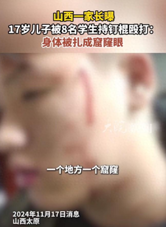 17岁学生被8名同学用钉棍殴打后含泪控诉，校方作出回应，但家长拒绝调解。
 
8