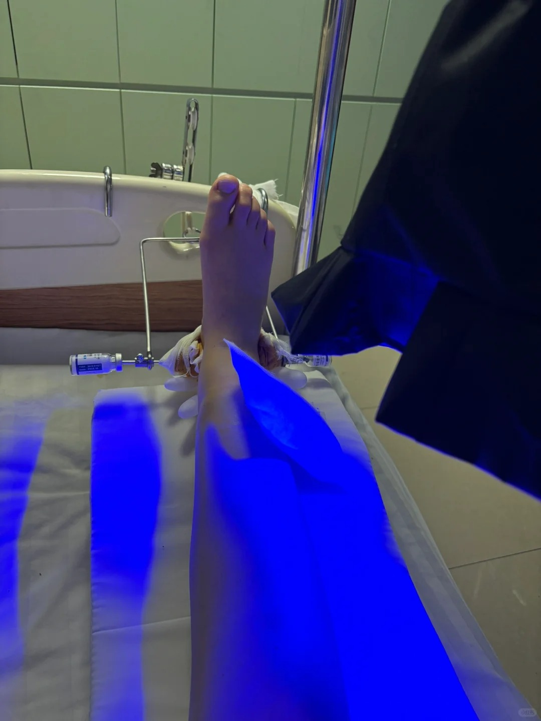 生平第一次感受灌肠｜大号累到虚脱
前提：大年初一腿断了在医院住院 现在是打着牵引