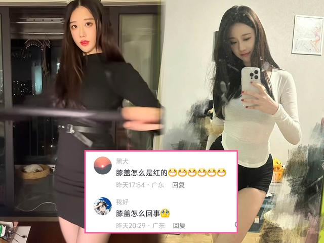 轩子巨2兔晒美照出现意外,膝盖出现明显伤痕,网友:羡慕力哥!-第5张图片-九妖电影 轩子巨2兔晒美照出现意外,膝盖出现明显伤痕,网友:羡慕力哥!-第5张图片-九妖电影