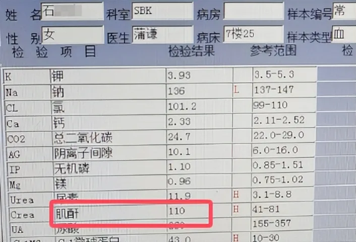 肌酐不到2个月降到110, 远离尿毒症追击, 这个方法让她受益匪浅