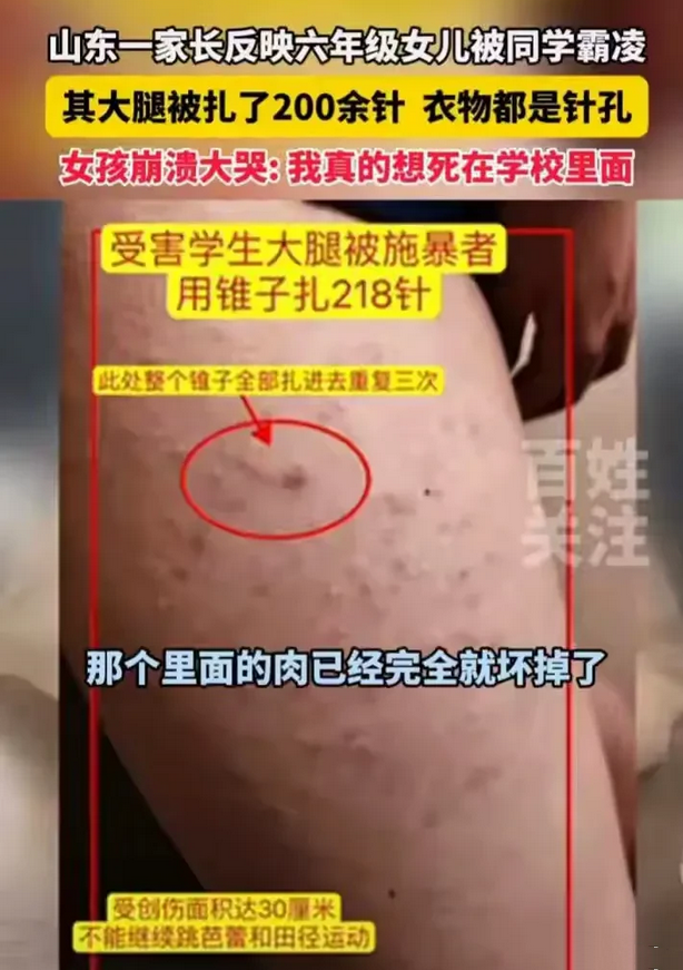 未达到霸凌标准！霸凌难道还有标准吗？
山东济南章丘双语学校，一名六年级的女生被她