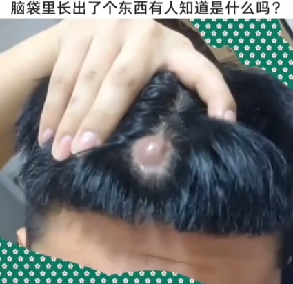 有人知道我头上的这个是什么吗