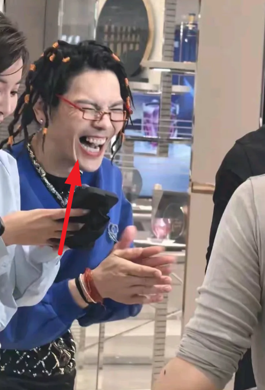 没想到向佐还缺了颗牙，难道这么大明星还没钱补牙吗？