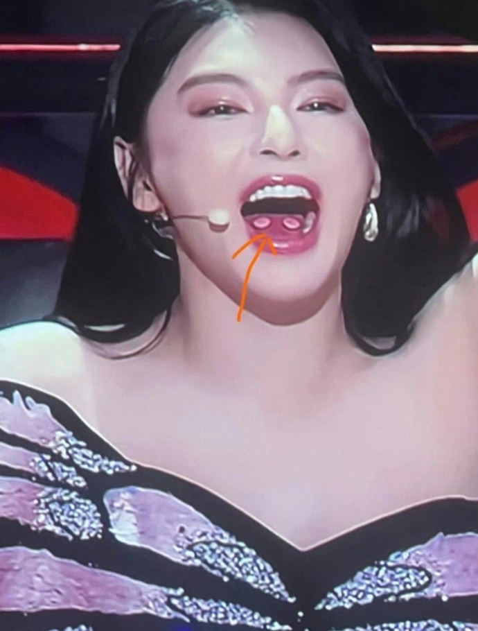 张雨绮在舌头上戴两个这么大的舌钉，看着都疼，这也不好看呀。