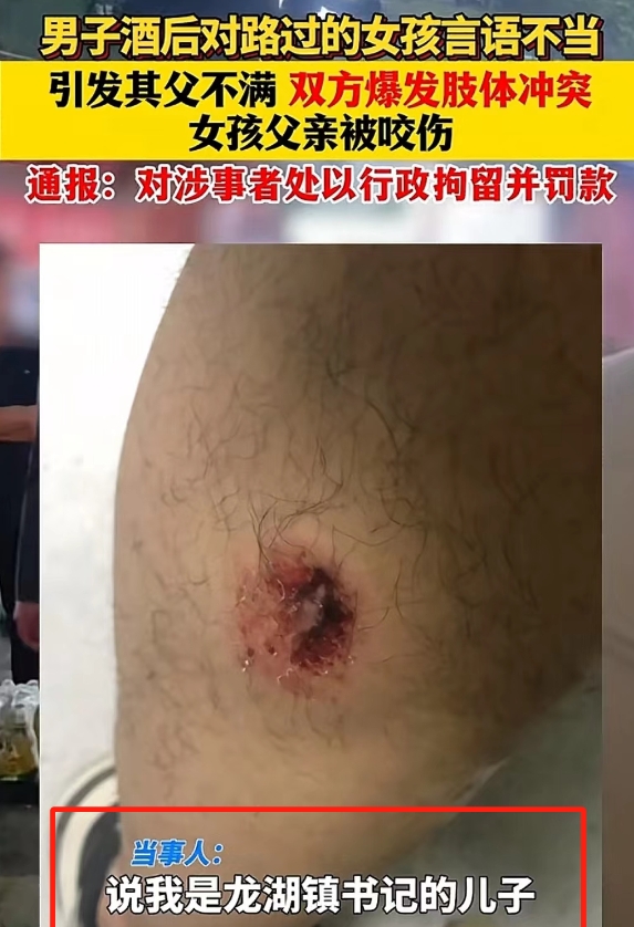 面对一群醉汉殴打一个人的情况，很多人都不敢上前干预，生怕自己也收到牵连，并且打人