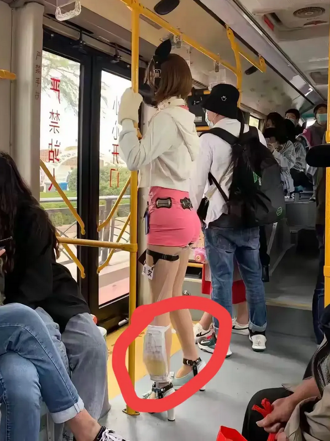 这个腿上是什么东西？