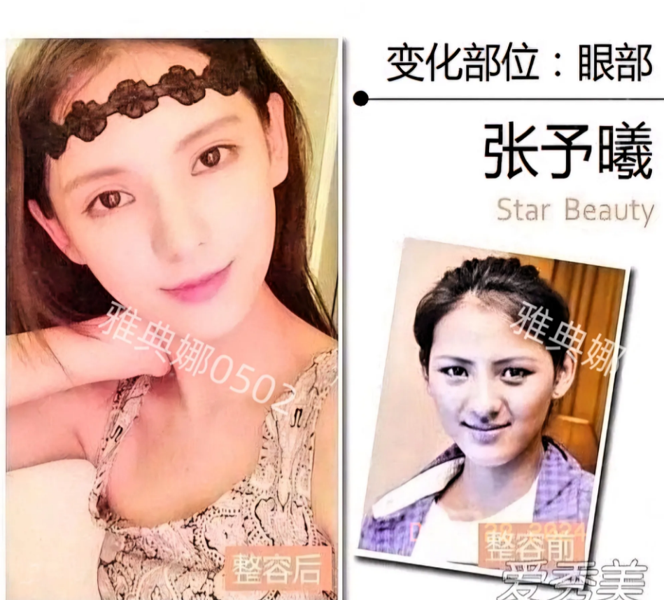 原来张予曦也是人工美女，以前的她又黑又村像个男人，现在的她精致得像个洋娃娃，整得