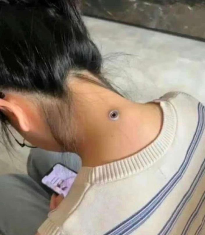 朋友的女友脖子上，这是什么东西？