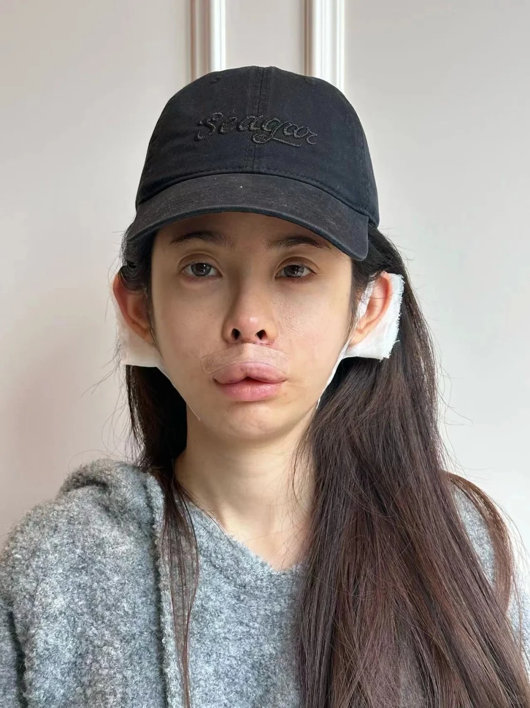 朋友说感觉越整越奇怪
