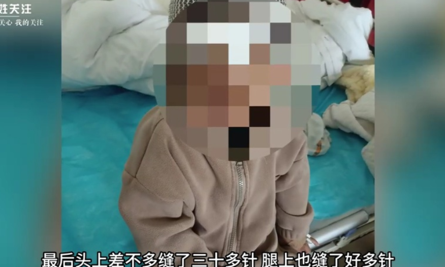 11月8日，3岁的小迪（化名）正和妈妈在广场上玩耍，一只未拴绳的罗威纳犬扑向了她