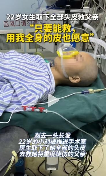 22岁的刘玥是个令人敬佩的女孩。为了挽救身受重伤的父亲，她毫不犹豫地选择用自己的