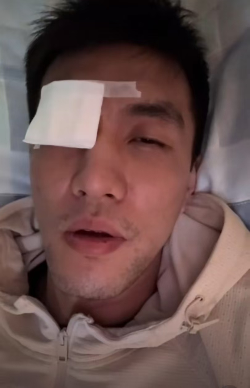 郭艾伦眼部重伤，赛季报销、全明星铁定缺席，甚至有可能影响篮球职业生涯