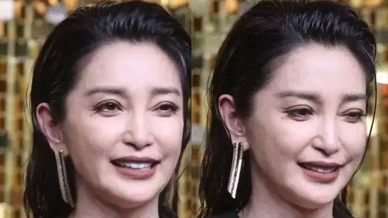 51岁李冰冰卸下“伪装“，取出假体融掉玻尿酸，选择自然老去