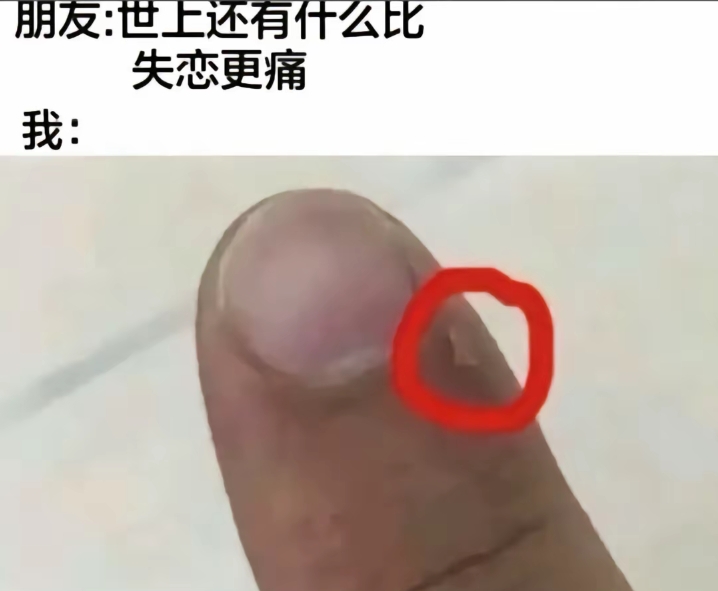 我：这才是最痛的