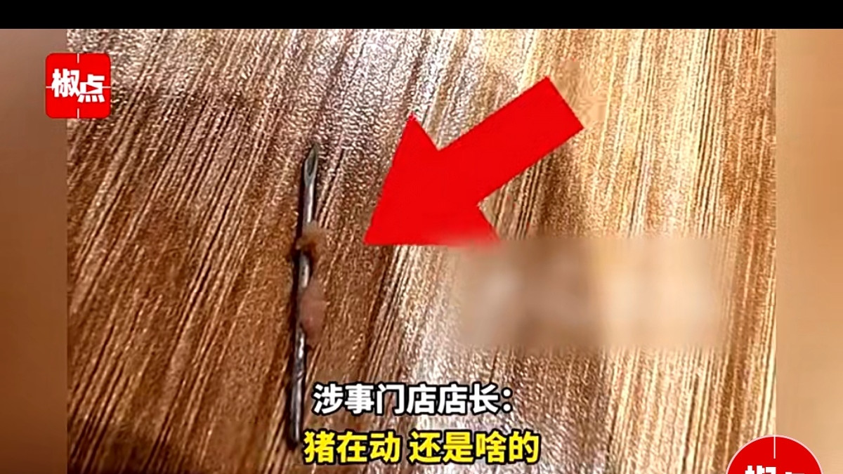 孩子吃水饺狂哭不止 家长拔出一根很长的针头