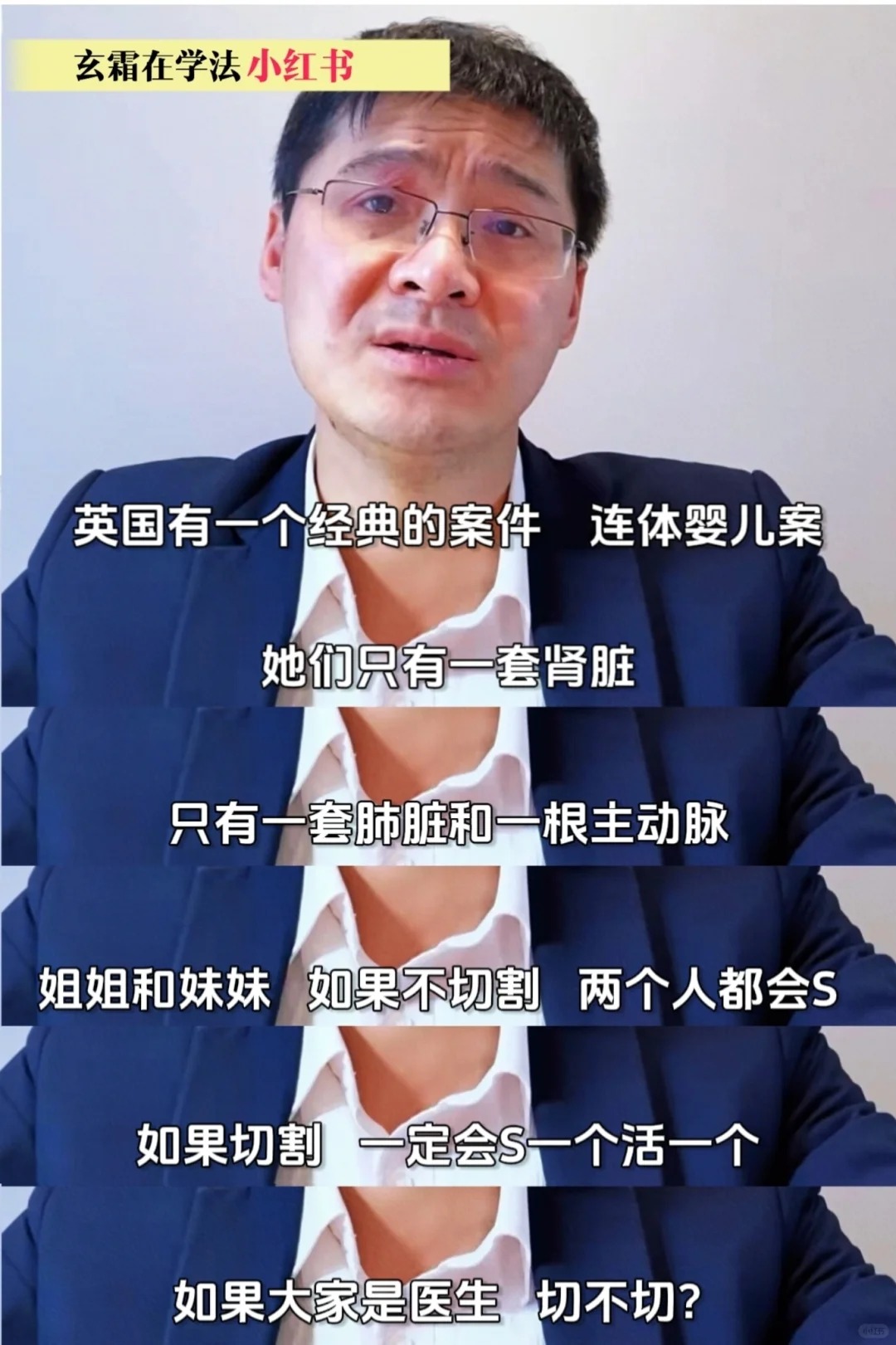 连体婴儿案
连体婴儿案
我好像听说过哎
很纠结啊，这个问题