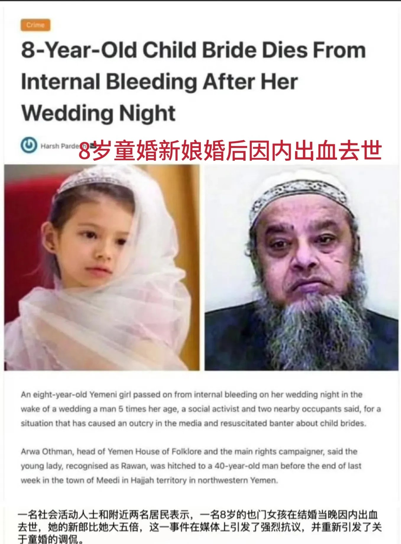  
也门一个8岁女孩新婚当晚，因为内出血去世，你没看错是8岁，
八岁女孩拉万的新