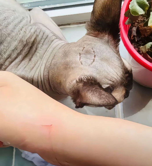 被猫抓伤了，要不要去打疫苗？