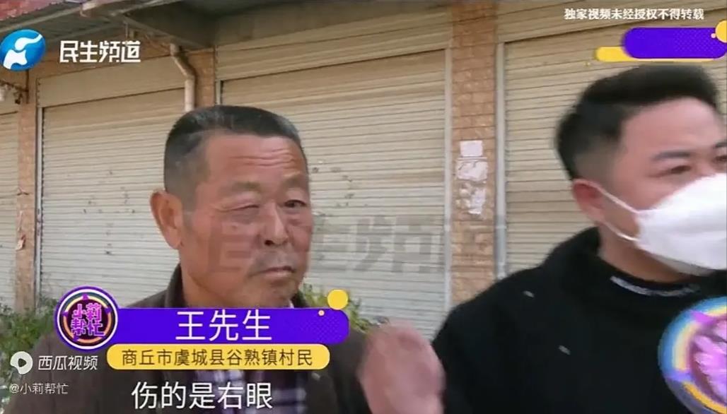 河南商丘，大爷右眼被飞起的钉子蹦伤，镇上医院拍了CT并开了药，谁知当晚疼痛难忍，