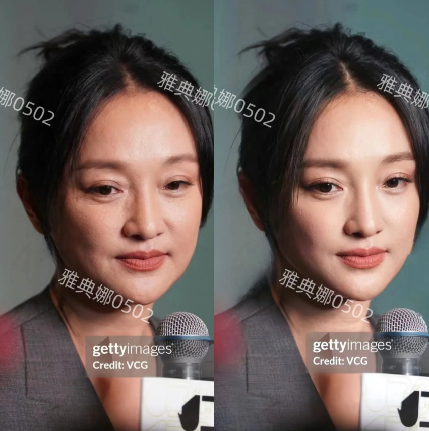 50岁的周迅老态还是挺明显的，皮肤松弛眼袋突出眼角皱纹很多，嘴角也向下耷拉。
网