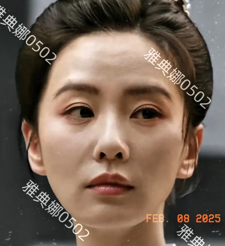 刘诗诗的脸怎么垮成这样？
37岁的她，中庭变长颧骨变高，鼻孔是三角形的，连眼睛都