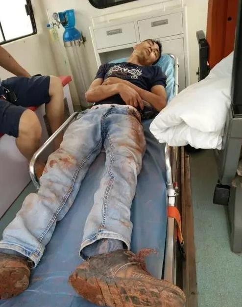 “胳膊拗不过大腿！”新疆乌鲁木齐，一男子提供劳务时意外受伤，导致左膝关节严重受损