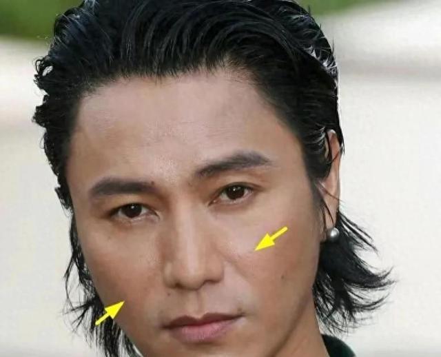 宁愿丑成“怪物”也要永葆青春，这7位明星早已整的“惨不忍睹”（十大明星整容失败）-第23张图片-九妖电影