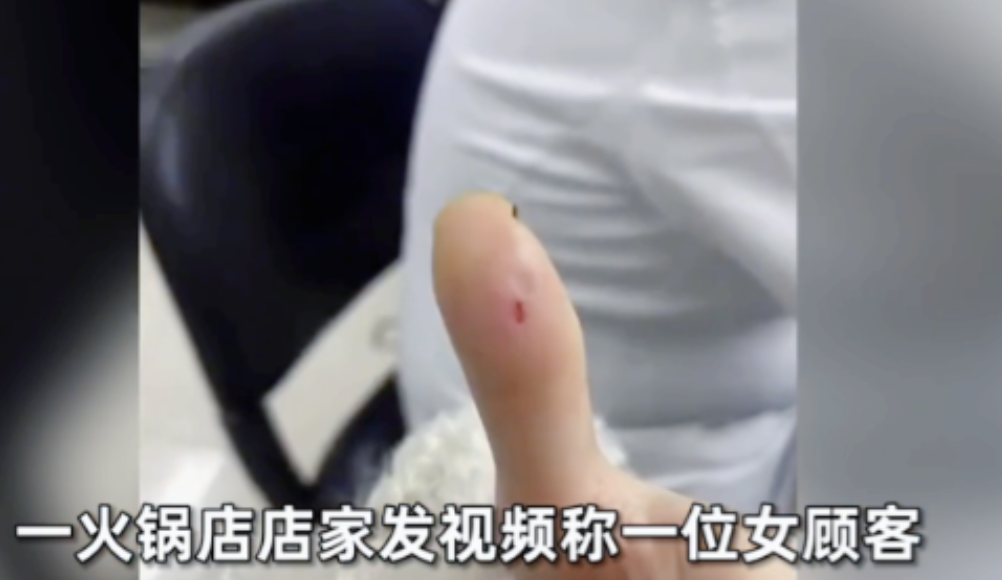 2024年陕西西安，女子用餐时，意外被筷子上的毛刺扎破手指，火锅店老板出于愧疚陪