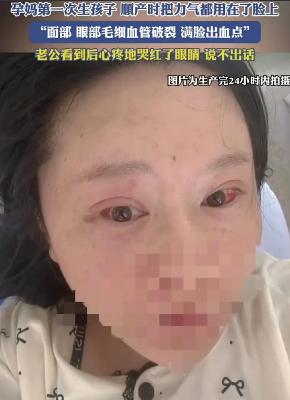 11月10日，山东一孕妈第一次生孩子，顺产过程中因不会用力了，结果把力气都用在了