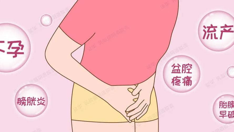 生殖道感染之滴虫性阴道炎——阴道微生态疗法