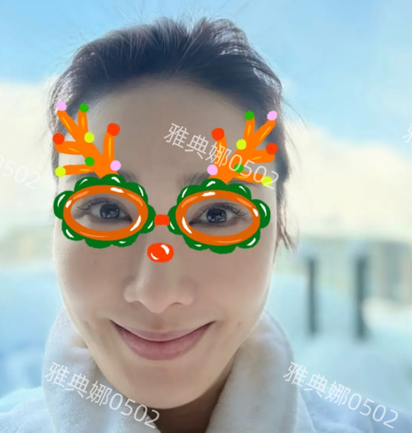 天啊，黎姿怎么变成这样了？猛一看以为是李嘉欣呢!
脸变长了，额头和苹果肌异常饱满