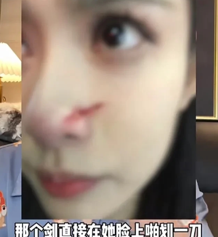 戒断昀牵孟绕的同时，一次又一次被孟子义圈粉，她鼻子原来被划了这么长
看到有人骂桃
