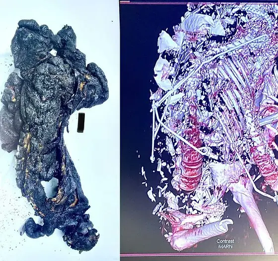 去年10月7日遇难的遗骸和CT 扫描显示，哈马斯分子将以色列父母和孩子一家三口用