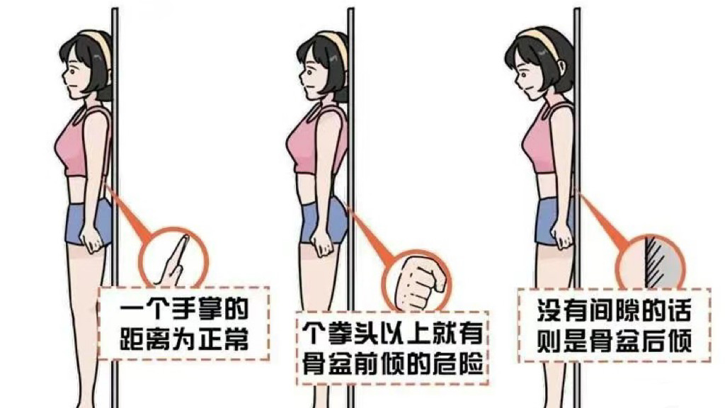 《青少年体态健康之骨盆异常的危害》