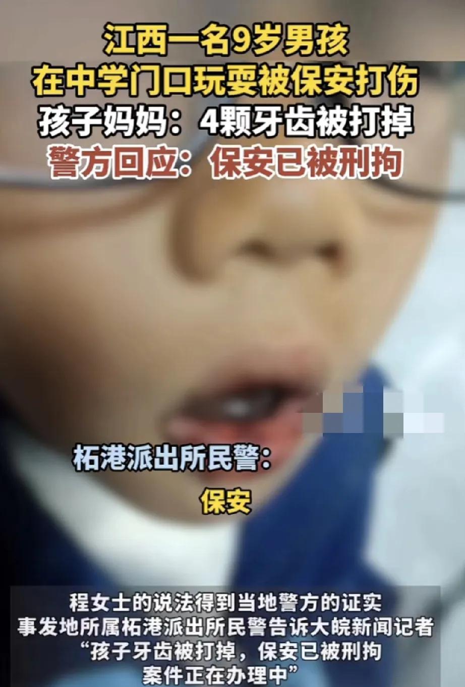 闹大了！江西，一名9岁男孩在中学门口玩耍，结果却被学校保安直接打掉了4颗牙齿。事