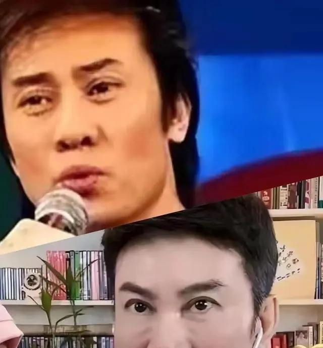 宁愿丑成“怪物”也要永葆青春，这7位明星早已整的“惨不忍睹”（十大明星整容失败）-第16张图片-九妖电影