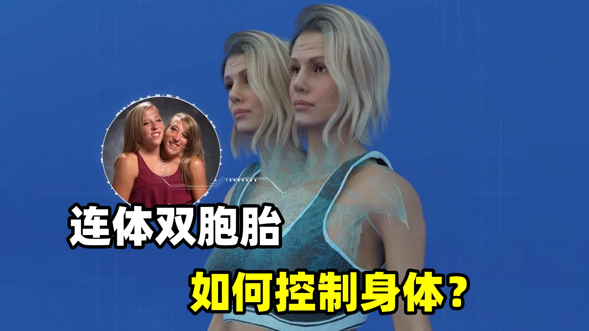 探秘连体双胞胎，是如何控制身体的