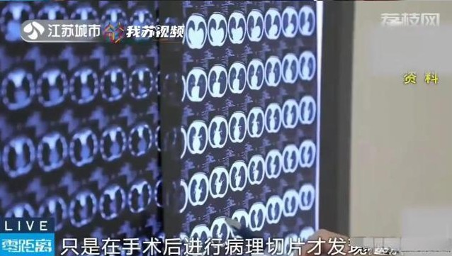 男子买保险后得癌 保险公司不赔

                       