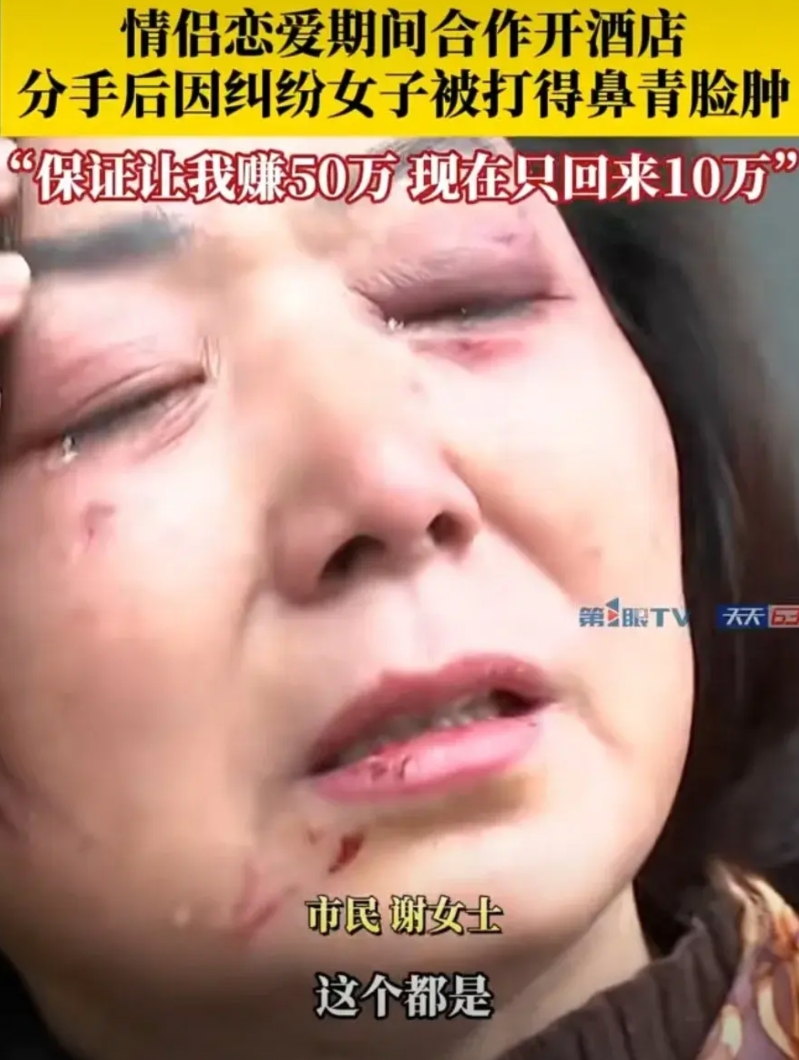 重庆中年女子找记者哭诉，她被男友打的伤痕累累，男友让她投资酒店，每年保证让她赚5