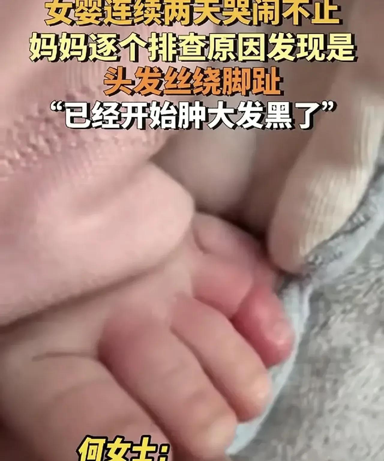 湖南长沙，女婴连续哭闹两天，家长想不出什么原因，准备去医院看看。妈妈在给孩子穿衣