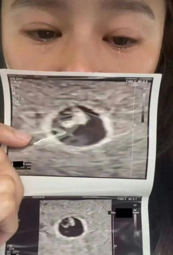 42岁黄翠如官宣怀孕，眼含热泪难掩幸福。
 
恭喜恭喜，很喜欢两位TVB剧演员。