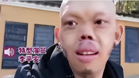“癞蛤蟆”成人生赢家？80后小伙长相怪异却迎娶美娇娘，日入过千