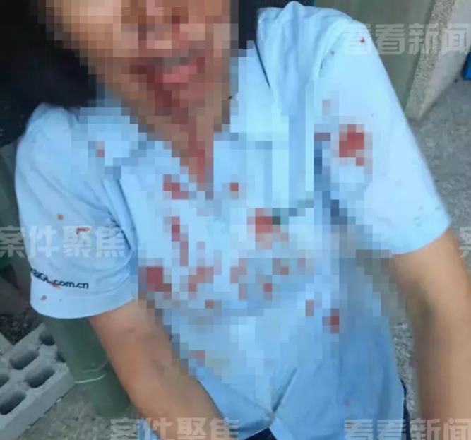 上海，一外甥带5人上门，对舅舅进行围殴，舅妈激愤之下，拿起一瓶强腐蚀性液体，直接