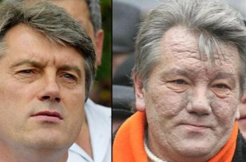 2004年，乌克兰总统候选人维克多•尤先科在总统选举前夕，因二恶英而中毒。
专家