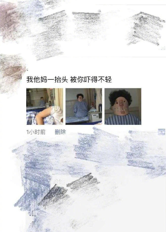 卧槽，医生我又有心脏病了