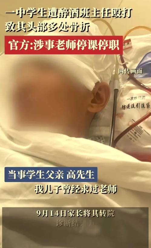 班主任喝醉后对学生疯狂殴打，造成学生头部多处骨折需做开颅手术！公安机关已介入！